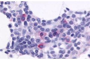 Immunohistochemical staining of human spleen with CXCR5 polyclonal antibody . (CXCR5 anticorps  (C-Term))
