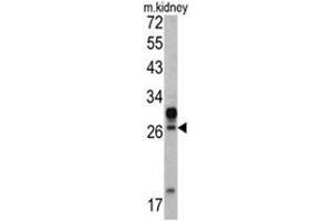 Western blot analysis of HOXA5 antibody (C-term E211) in mouse kidney tissue lysates (35ug/lane).