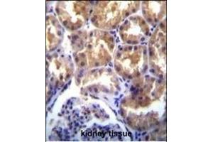 TR(CHAK2) Antibody (Center) (ABIN392616 and ABIN2842133) immunohistochemistry analysis in formalin fixed and paraffin embedded human kidney tissue followed by peroxidase conjugation of the secondary antibody and DAB staining. (TRPM6 anticorps  (AA 317-348))