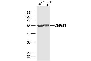 Lane 1: Hela lysates Lane 2: Siha lysates probed with ZNF671 Polyclonal Antibody, Unconjugated  at 1:300 dilution and 4˚C overnight incubation. (ZNF671 anticorps  (AA 101-200))