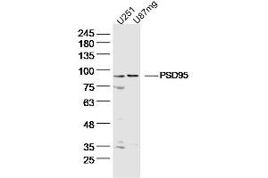 Lane 1: U251 lysates Lane 2: U87mg lysates probed with DLG4 Polyclonal Antibody, Unconjugated  at 1:300 dilution and 4˚C overnight incubation. (DLG4 anticorps  (AA 351-450))