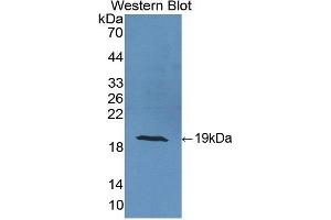 Detection of Recombinant CRABP2, Human using Polyclonal Antibody to Cellular Retinoic Acid Binding Protein 2 (CRABP2)
