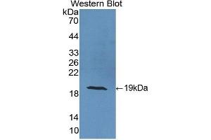 Detection of Recombinant CRABP2, Human using Polyclonal Antibody to Cellular Retinoic Acid Binding Protein 2 (CRABP2) (CRABP2 anticorps  (AA 1-138))
