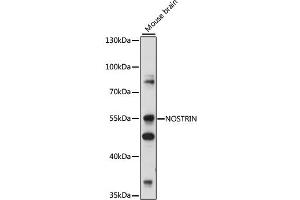 Western blot analysis of extracts of various cell lines, using NOSTRIN antibody (ABIN7268922) at 1:1000 dilution. (NOSTRIN anticorps  (AA 207-506))