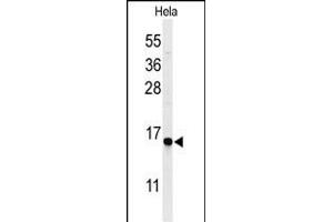 Western blot analysis of GABARL1 Antibody 9133a in Hela cell line lysates (35 μg/lane). (GABARAPL1 anticorps)