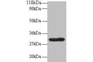 Western blot All lanes: GPR161 antibody at 2 μg/mL + EC109 whole cell lysate Secondary Goat polyclonal to rabbit IgG at 1/15000 dilution Predicted band size: 59, 46, 44, 50, 47, 61 kDa Observed band size: 30 kDa (GPR161 anticorps  (AA 1-28))