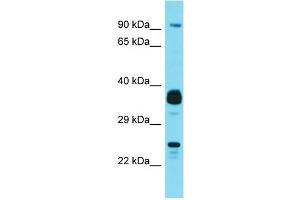 Western Blotting (WB) image for anti-Josephin Domain Containing 1 (JOSD1) (N-Term) antibody (ABIN2791598) (JOSD1 anticorps  (N-Term))