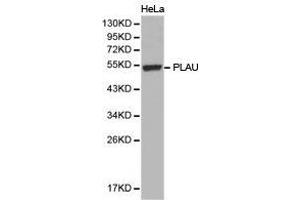 Western Blotting (WB) image for anti-Plasminogen Activator, Urokinase (PLAU) antibody (ABIN1874158) (PLAU anticorps)
