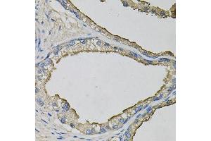 Immunohistochemistry of paraffin-embedded human prostate using LCN1 antibody (ABIN6003560) at dilution of 1/100 (40x lens). (Lipocalin 1 anticorps)