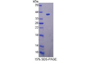 SDS-PAGE (SDS) image for Uridine Phosphorylase 2 (UPP2) (AA 1-320) protein (His tag) (ABIN4990283)