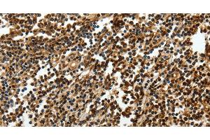 Immunohistochemistry of paraffin-embedded Human tonsil using SOX-13 Polyclonal Antibody at dilution of 1:50 (SOX13 anticorps)
