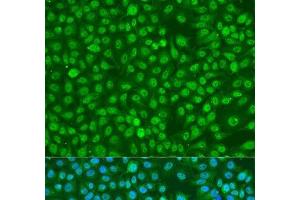 Immunofluorescence analysis of U2OS cells using Phospho-BRCA1(S1423) Polyclonal Antibody at dilution of 1:100. (BRCA1 anticorps  (pSer1423))