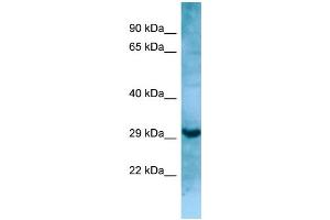 WB Suggested Anti-MASP1 Antibody Titration: 1. (MASP1 anticorps  (N-Term))