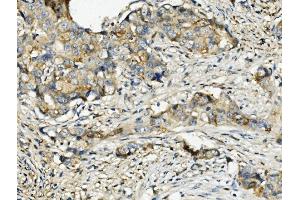 IHC analysis of Ribonuclease Inhibitor/RNH1 using anti-Ribonuclease Inhibitor/RNH1 antibody (ABIN7603117). (RNH1 anticorps  (N-Term))