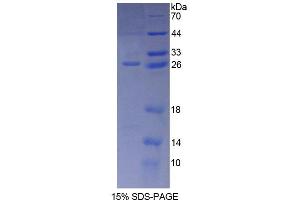 SDS-PAGE (SDS) image for CD300c (CD300C) (AA 21-183) protein (His tag) (ABIN6238710) (CD300c Protein (CD300C) (AA 21-183) (His tag))