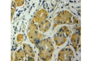 Used in DAB staining on fromalin fixed paraffin-embedded Stomach tissue (CSNK1A1 anticorps  (AA 130-337))