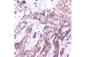 IHC analysis of SMN1/2 using anti-SMN1/2 antibody (ABIN5693315).