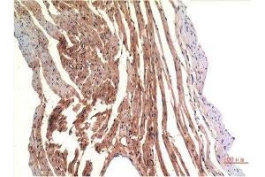 Immunohistochemical analysis of paraffin-embedded Rat Heart Tissue using VE-Cadherin Mouse mAb diluted at 1:200.