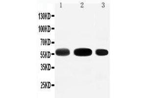 Anti-EAAT3 antibody,  Western blotting Lane 1: Rat Liver Tissue Lysate Lane 2: Rat Heart Tissue Lysate Lane 3: HEPA Cell Lysate