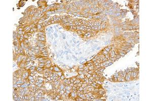 Immunohistochemistry (IHC) image for anti-CD47 (CD47) (AA 19-142) antibody (ABIN7449426)