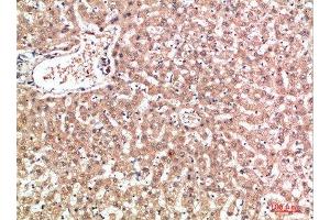 Immunohistochemical analysis of paraffin-embedded human-liver, antibody was diluted at 1:200 (EPG5 anticorps  (AA 141-190))