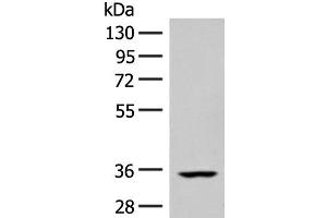Western blot analysis of Human heart tissue lysate using FBXO16 Polyclonal Antibody at dilution of 1:400 (FBXO16 anticorps)