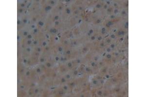 IHC-P analysis of Human Tissue, with DAB staining. (APOA1 anticorps  (AA 122-267))