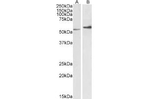 ABIN2613493 (0. (Vimentin anticorps  (C-Term))