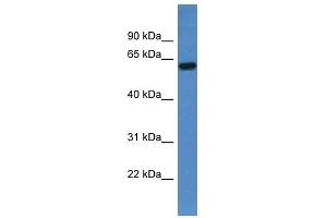 Western Blot showing TCHP antibody used at a concentration of 1-2 ug/ml to detect its target protein.
