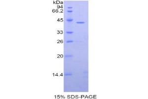 SDS-PAGE (SDS) image for Carboxypeptidase O (CPO) (AA 21-374) protein (His tag) (ABIN1099097)