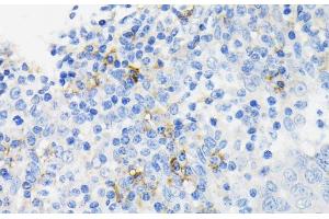 Immunohistochemistry of paraffin-embedded Human tonsil using CAMP Polyclonal Antibody at dilution of 1:200 (40x lens). (Cathelicidin anticorps)