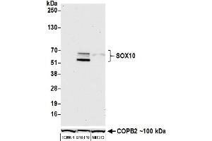 Western Blotting (WB) image for anti-SRY (Sex Determining Region Y)-Box 10 (SOX10) (AA 416-466) antibody (ABIN7455186) (SOX10 anticorps  (AA 416-466))