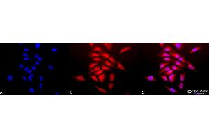 Immunocytochemistry/Immunofluorescence analysis using Rabbit Anti-SOD (Cu/Zn) Polyclonal Antibody . (SOD1 anticorps  (PerCP))