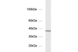 dilution: 1 : 1000, sample: P2 of rat pancreas (Syntaxin 18 anticorps  (AA 55-313))
