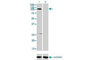 Western blot analysis of GABBR1 over-expressed 293 cell line, cotransfected with GABBR1 Validated Chimera RNAi (Lane 2) or non-transfected control (Lane 1).
