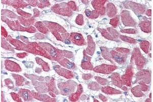 Heart, Human: Formalin-Fixed, Paraffin-Embedded (FFPE) (CRYAB anticorps)