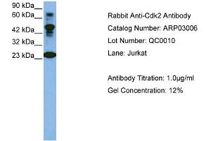 Western Blotting (WB) image for anti-Cyclin-Dependent Kinase 2 (CDK2) (C-Term) antibody (ABIN184162) (CDK2 anticorps  (C-Term))