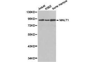 Western Blotting (WB) image for anti-Mucosa Associated Lymphoid Tissue Lymphoma Translocation Gene 1 (MALT1) antibody (ABIN1873591) (MALT1 anticorps)
