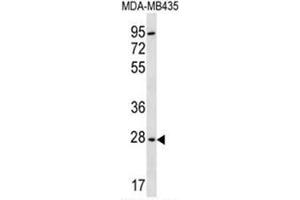 BPGM Antibody (C-term) western blot analysis in MDA-MB435 cell line lysates (35µg/lane).