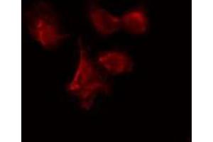 ABIN6274085 staining Hela cells by IF/ICC. (CDC7 anticorps  (N-Term))