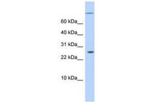 Image no. 1 for anti-AT Rich Interactive Domain 5A (MRF1-Like) (ARID5A) (N-Term) antibody (ABIN6743583) (ARID5A anticorps  (N-Term))