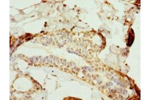 Immunohistochemistry of paraffin-embedded human breast cancer using ABIN7169124 at dilution of 1:100