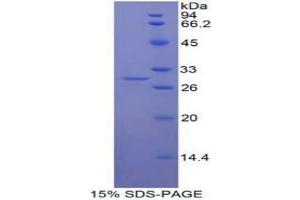 SDS-PAGE analysis of Human Mindbomb Homolog 2 Protein. (MIB2 Protéine)