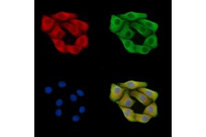 ABIN7095697 and ABIN7099759 staining Hela cells by IF/ICC. (MAN1A1 anticorps)