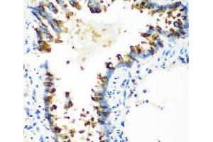 Immunohistochemistry of paraffin-embedded Rat lung using MTCO2 Polyclonal Antibody at dilution of 1:100 (40x lens). (COX2 anticorps)