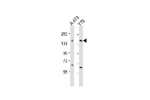 All lanes : Anti-CACNA1F Antibody (Center) at 1:2000 dilution Lane 1: A-673 whole cell lysate Lane 2: Y79 whole cell lysate Lysates/proteins at 20 μg per lane. (CACNA1F anticorps  (AA 743-776))