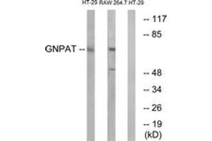 Western Blotting (WB) image for anti-Glyceronephosphate O-Acyltransferase (GNPAT) (AA 231-280) antibody (ABIN2890262) (GNPAT anticorps  (AA 231-280))