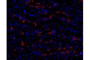 Immunohistochemistry (IHC) image for anti-Early Endosome Antigen 1 (EEA1) (AA 2-13) antibody (ABIN1742484)