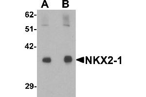 Western blot analysis of NKX2-1 in rat lung tissue lysate with NKX2-1 antibody at (A) 1 and (B) 2 µg/mL. (NKX2-1 anticorps  (N-Term))