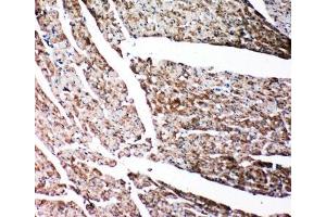 IHC-P: Gelsolin antibody testing of rat heart tissue.